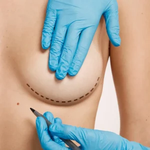 Reconstrucción mamaria