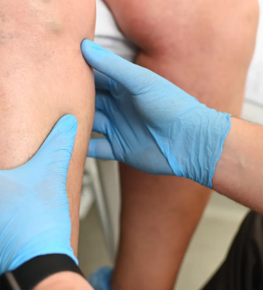 lymphedema_1_980x587_original_resultado